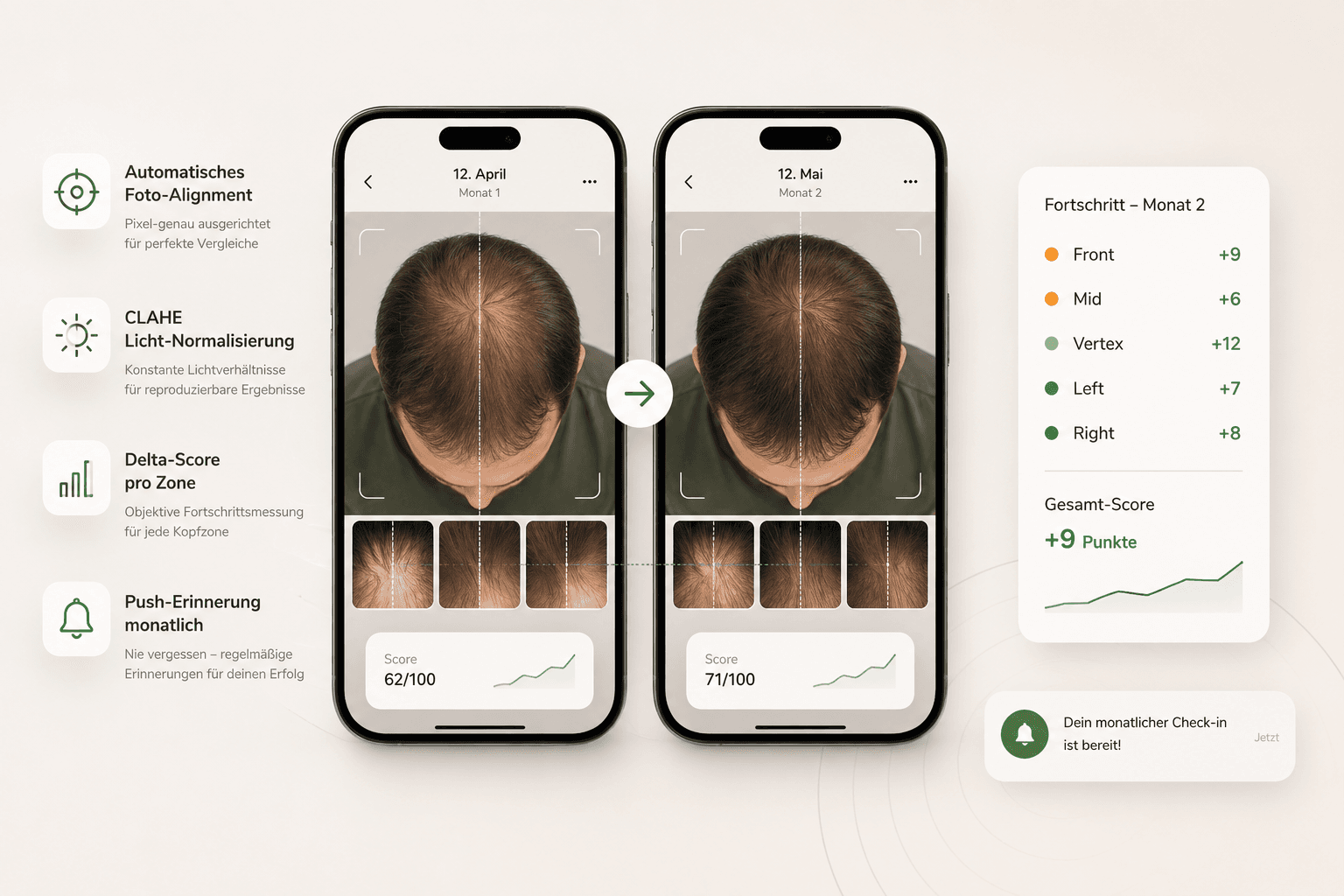 Hairlens Haar-Tracking Dashboard – Monatlicher Verlaufsvergleich mit Delta-Scores